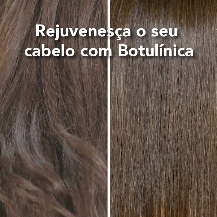 Antes e depois do pack Botulínica